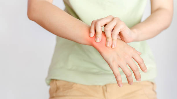 istock A woman sprained her wrist from office syndrome. 1488321656