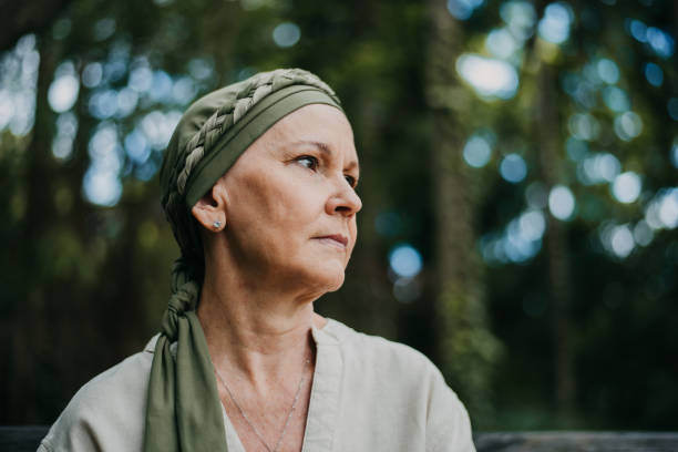 암 종양학 환자를 가진 여자의 초상화 - 세리아 뉴스 사진 이미지