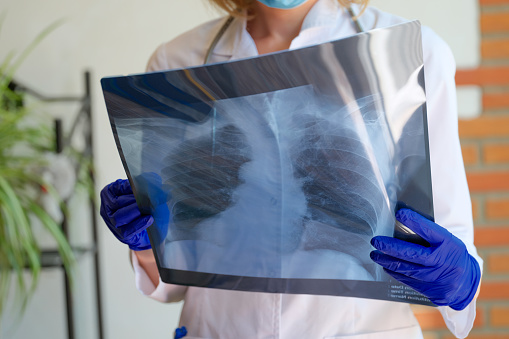 Close-up of doctor holding x-ray photograph of lungs in hands. Radiologist or pulmonologist making diagnostic of patient. Medicine and checkup concept