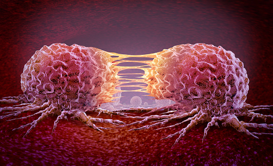 Metastasis Cancer cell and oncology or Malignant Cancerous Growth as growing dividing tumor cells and Malignancy disease spreading metastasized on an organ inside the human body as a 3D illustration.
