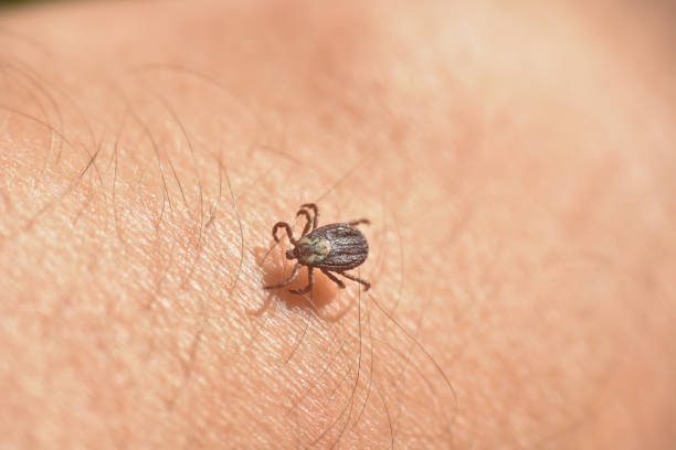 istock Infected tick on hairy human skin 1488512741