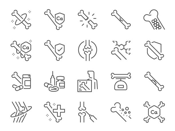 ilustraciones, imágenes clip art, dibujos animados e iconos de stock de conjunto de iconos de hueso. incluía los iconos ortopédicos, de calcio, de anatomía y más. - osteoporosis