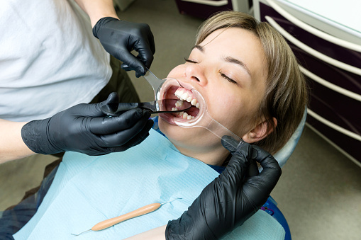 Doctor dentist with help of assistant examines oral cavity patient before procedure reconstruction tooth on upper jaw