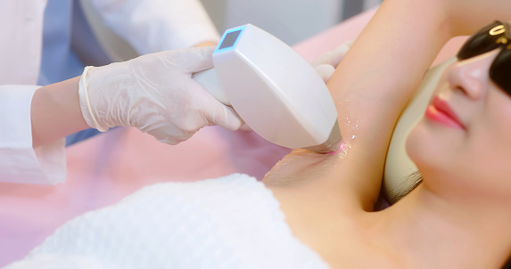close up armpit of asian woman lying on bed is receiving underarm hair removal procedure with laser machine and feel relaxed while female doctor holding cosmetology device in clinic