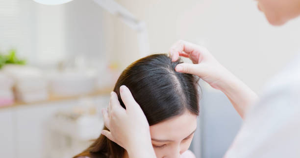 doctor examines scalp with hands close up asian professional female dermatologist examines head skin of woman with her hands while they discussing in clinic cuticle photos stock pictures, royalty-free photos & images