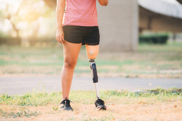 atleta usando uma prótese de perna aquecendo no parque. mulher correndo enquanto usa equipamento protético. feche uma mulher com uma prótese de perna. - aquecimento físico - fotografias e filmes do acervo