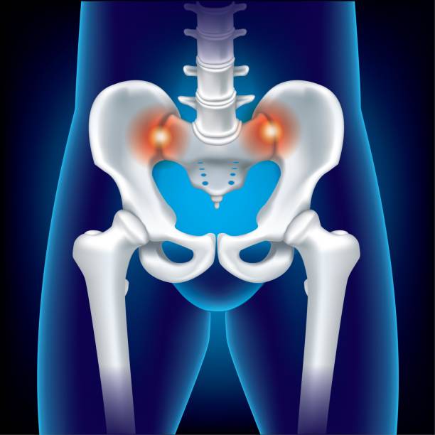 ilustraciones, imágenes clip art, dibujos animados e iconos de stock de primer plano pelvis humana o hueso de la cadera y fémur de la cabeza- ilustración médica en 3d- película azul de rayos x- salud- anatomía humana y concepto médico-aislado sobre fondo azul. ilustración de una articulación dolorosa de la cadera - sacrum