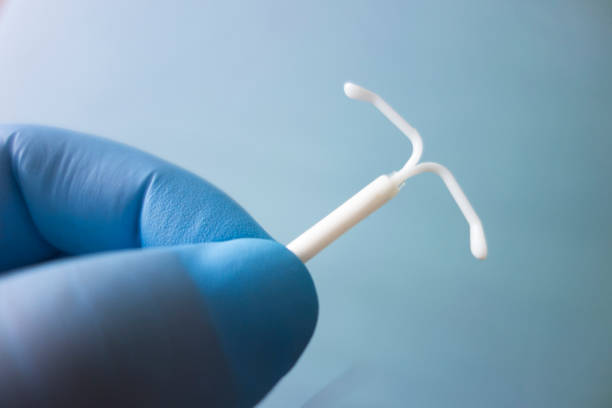 Intrauterine device (IUD) stock photo
