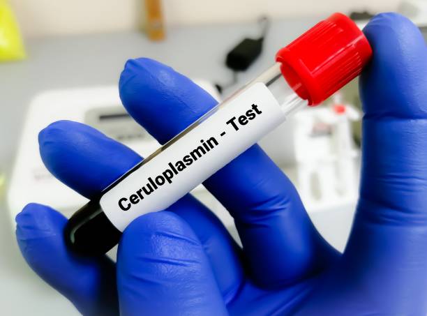 istock Blood sample for Ceruloplasmin test, major copper caring protein in blood. it is also play a role in iron metabolism 1489026797
