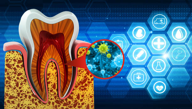 infecção bacteriana do dente humano - endocardite - fotografias e filmes do acervo