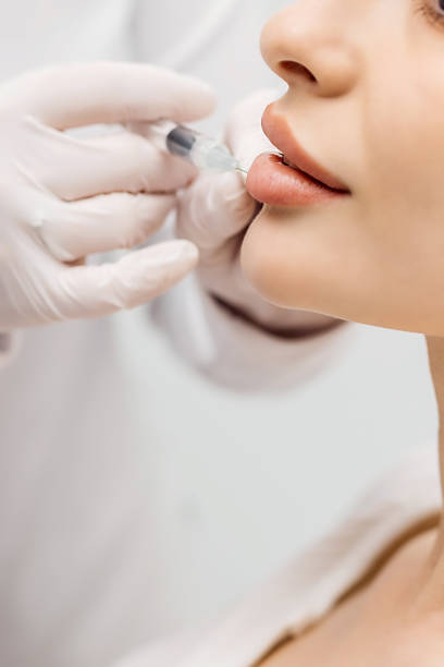 istock Lip Augmentation. Woman Getting Beauty Injection For Lips 1489067904