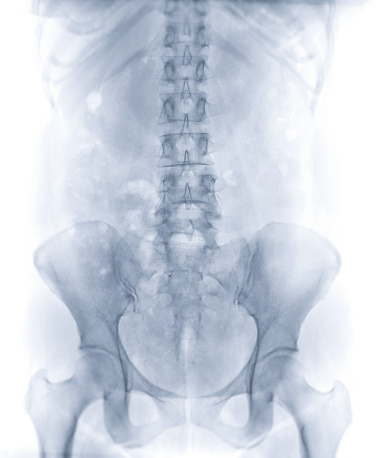 Plain Abdomen or plain kub is x-ray image of human abdominal part.