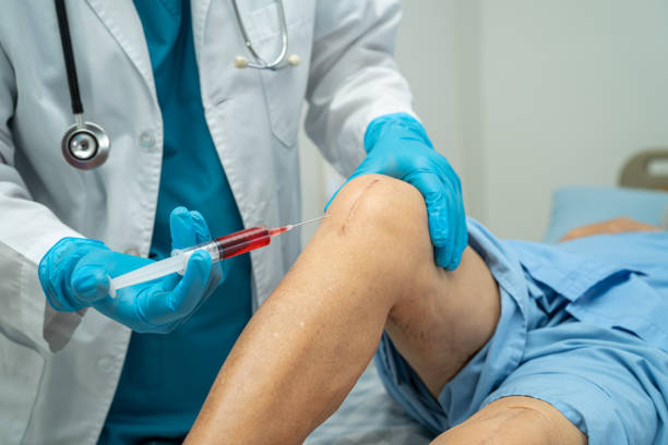 istock Asian elderly woman patient show her scars surgical total knee joint replacement Suture wound surgery arthroplasty in hospital, healthy strong medical concept. 1489147300