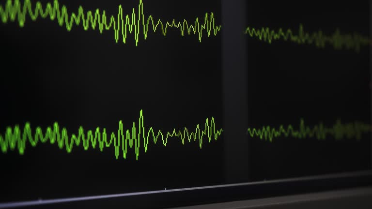 EEG waveform of patient