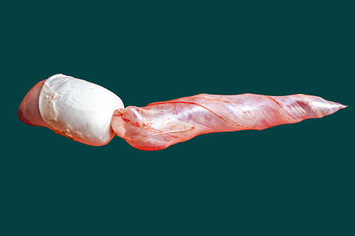 Air bladder or swim bladder of carp fish. Zoology practical, Fish anatomy