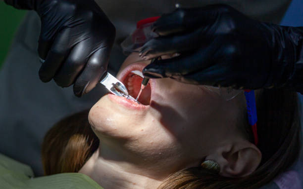 istock A woman at a dentist's appointment to replace arches with braces 1490259497