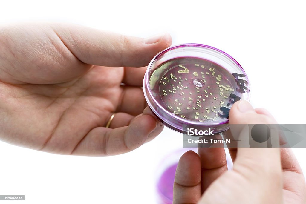 Escherichia coli - Foto de stock de Comparación libre de derechos