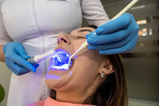 Escáner Intraoral
