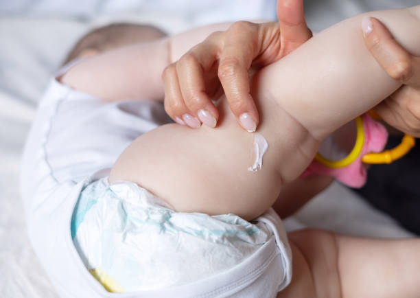 istock baby hand.mom apply cream toddler leg,rash 1490928232