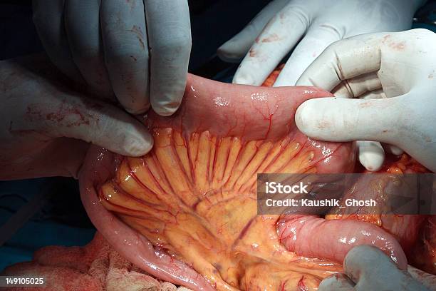 Small Intestine With Mesentry Stock Photo - Download Image Now - Mesentery, Abdomen, Surgery