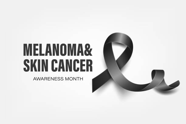 istock Melanoma, Skin Cancer Banner, Card, Placard with Vector 3d Realistic Black Ribbon on White Background. Melanoma, Skin Cancer Awareness Month Symbol Closeup, May. World Melanoma Day Concept 1491111707