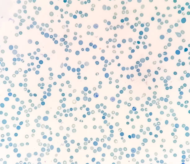 istock Close view of Reticulocyte count under microscope. methylene blue staining 1491224760
