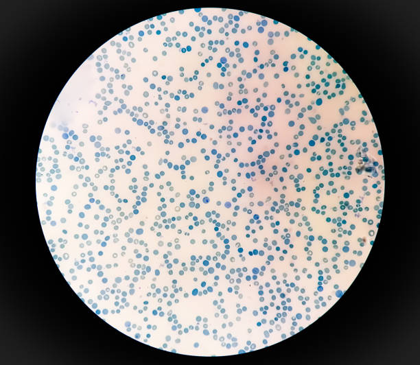 istock Close view of Reticulocyte count under microscope. methylene blue staining 1491224777