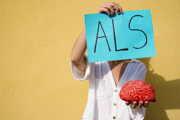 unrecognizable woman holding a als acronym card and a brain. muscle and neurone illness. amyotrophic lateral sclerosis day - esclerose lateral amiotrófica imagens e fotografias de stock