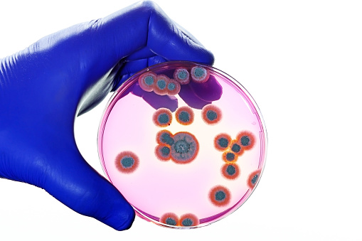 Fungal colonies isolated in the scientific research laboratory