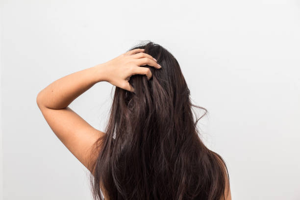 istock Women itching scalp itchy his hair 1491523921
