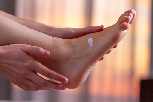 Woman applying hydrating, moisturizing cream. Foot and skin care. Heel protection and hydration