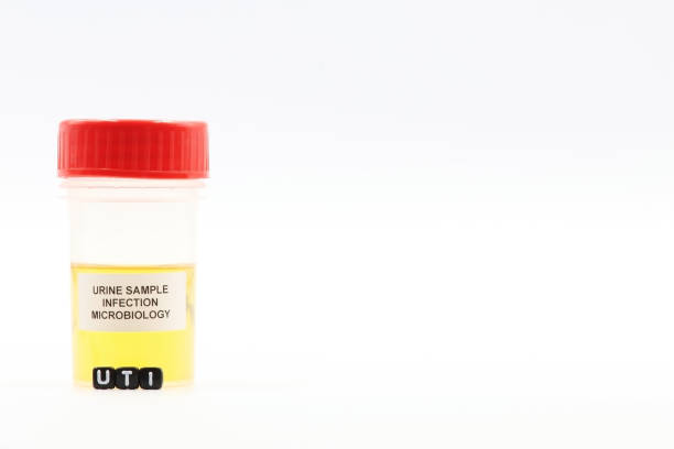 istock Urine bottle for microbiological analysis and urinary tract infection (UTI) samples. Space for text 1491789171
