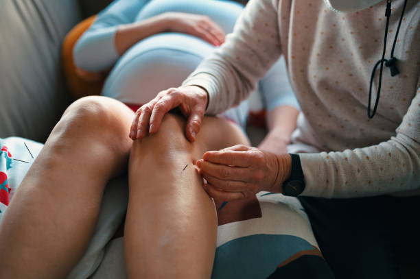 getting acupuncture - acupuncturist imagens e fotografias de stock