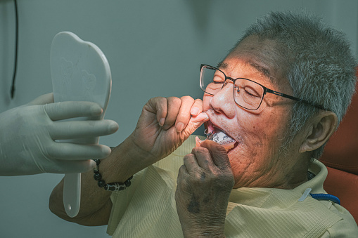 Asian Chinese senior man inserting dentist denture in his mouth at Dentist office