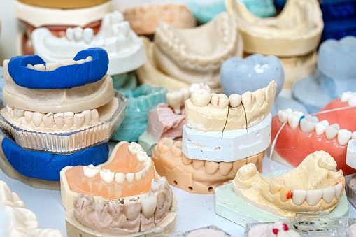3d render of teeth with convergent diastema and braces. Divergent diastema correction concept.