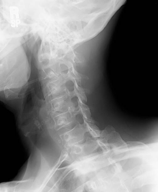 Cervical X-Ray stock photo