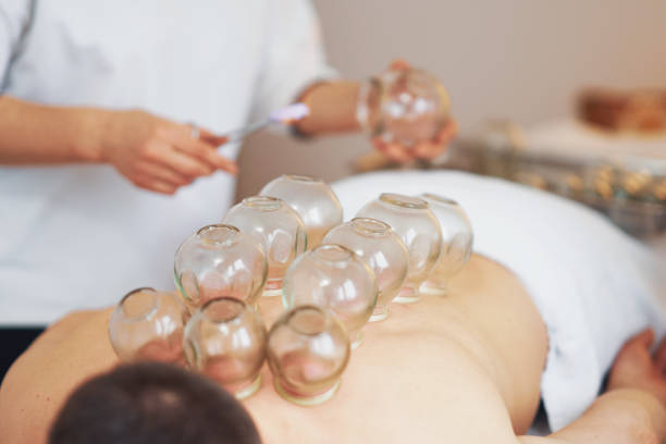 istock A picture of a man having cupping therapy 1492305595