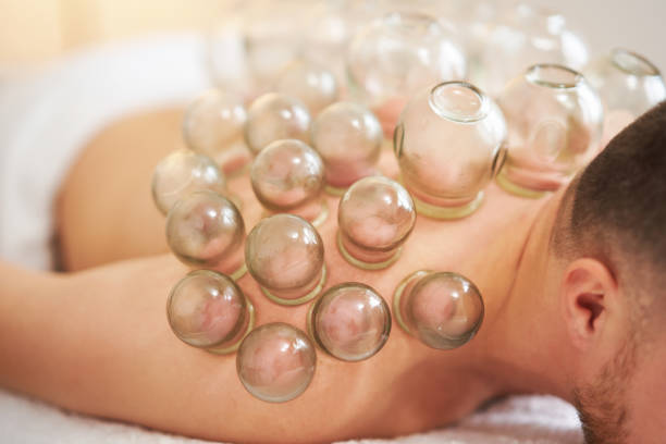 istock A picture of a man having cupping therapy 1492305988