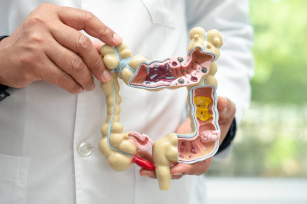 istock Intestine, appendix and digestive system, doctor holding anatomy model for study diagnosis and treatment in hospital. 1492366429