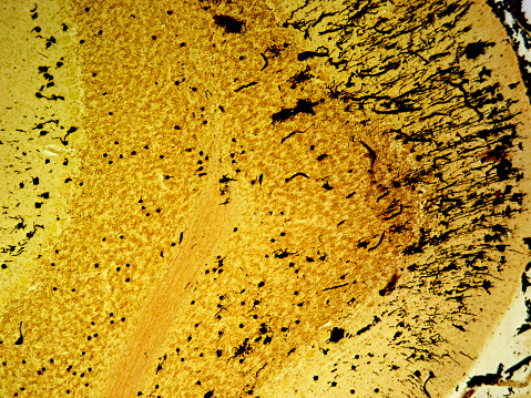 Precise histology image of the layers of the cerebellum, expertly golgi stained and viewed at 100x magnification, demonstrating the intricate complexities of this essential brain structure