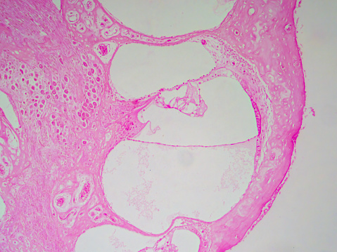 Detailed histology image of a guinea pig cochlea showing the Organ of Corti at 100x magnification, providing an insightful view into the mechanics of hearing