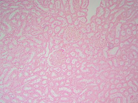 Detailed histology image of a guinea pig cochlea showing the Organ of Corti at 100x magnification, providing an insightful view into the mechanics of hearing