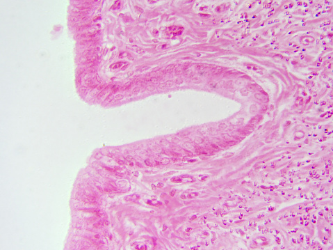 Detailed histology image of the spinal cord dorsal horn, silver stained and captured at 100x magnification.