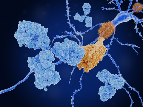 Immunotherapy of Alzheimer's disease: Monoclonal antibody (light blue) bound to an amyloid beta peptide (orange),  that is aggregated to amyloid beta fibrils, which build up amyloid plaques.