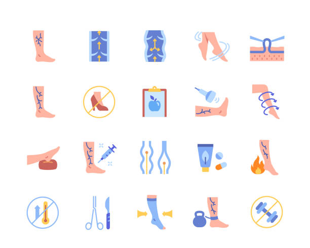 Varicose color icons set Varicose color icons set. Vascular varices circulation insufficiency. Disease of veins and circulatory system. Medical graphic elements for website and app. Flat vector illustration collection feet up stock illustrations