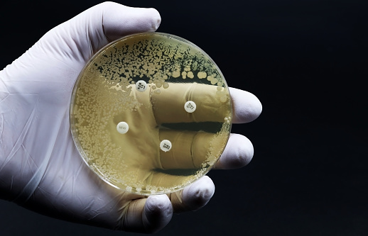 Hand of scientist or doctor showing a microbiological culture Petri dish with bacteria where an antibiotic resistance test has been carried out