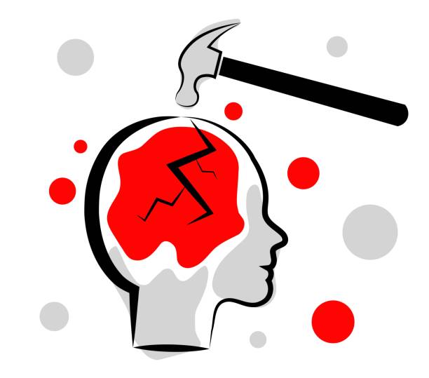 80+ Concussion Drawing Stock Photos, Pictures & RoyaltyFree Images