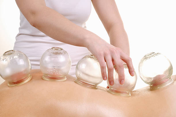 cupping massage stock photo