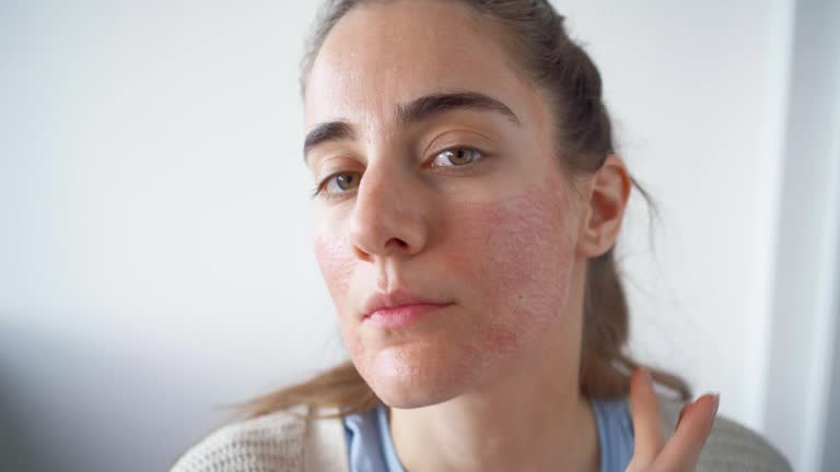 A woman puts cream on her face after face treatment