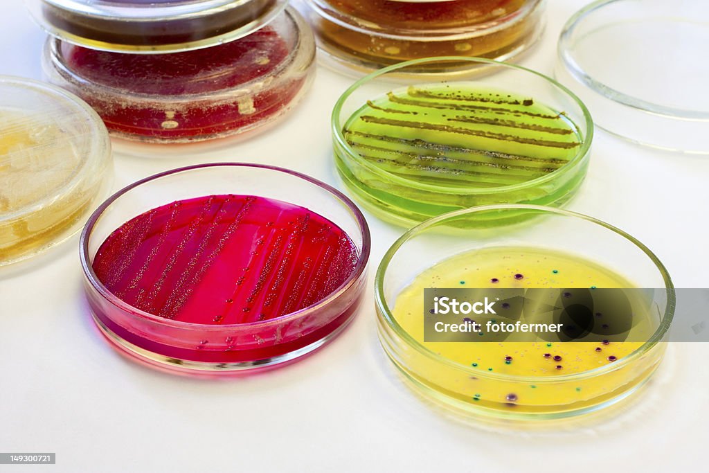 Petri dishes with bacterial colonies Petri dishes with bacterial colonies. Closeup. Agar Jelly Stock Photo